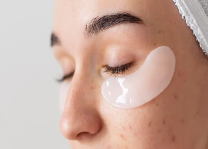 Find the Best Moisturizer for Acne-Prone Skin